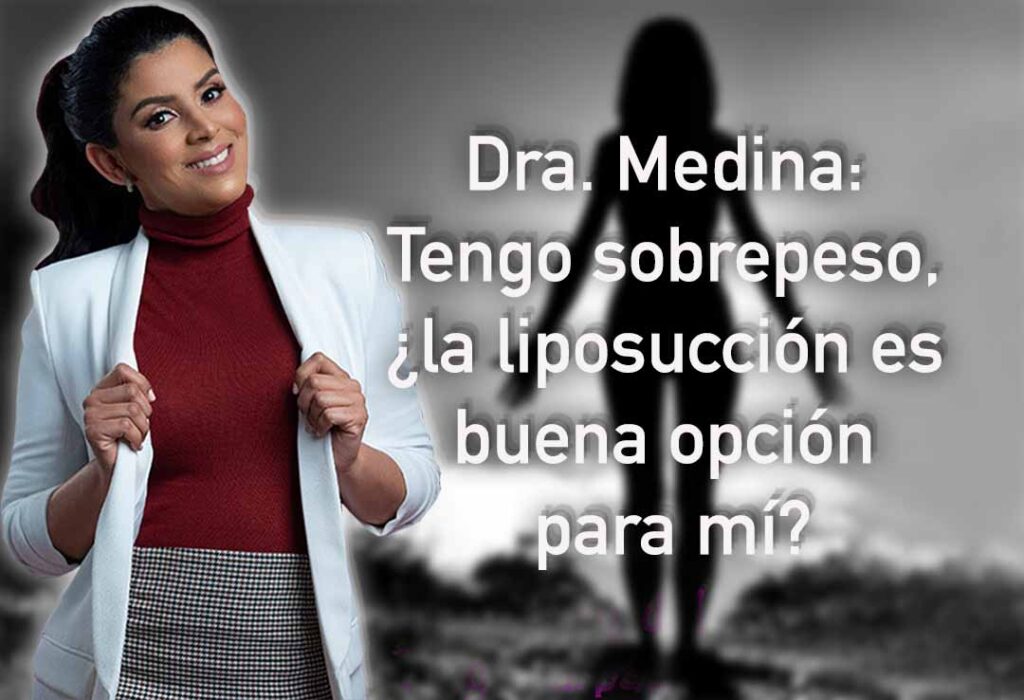 Dra. Medina, tengo sobrepeso, ¿la liposucción es buena opción para mí?